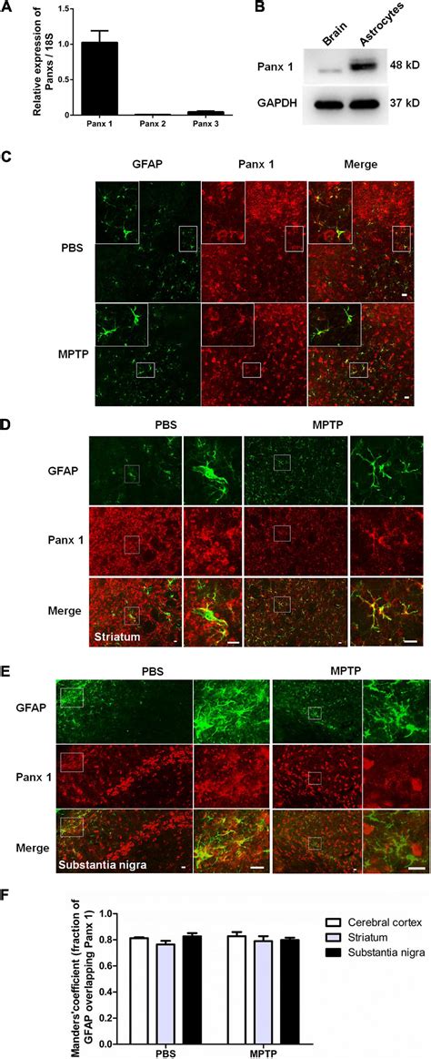 Frontiers Astrocyte Pannexin 1 Suppresses LPS Induced Inflammatory