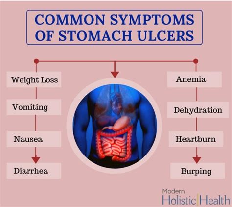 Best Natural Solutions for Stomach Ulcers | Modern Holistic Health