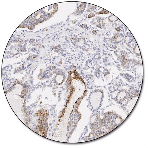 Pd L Ihc C Pharmdx For Use With Dako Omnis Agilent Off