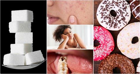 8 Alarming Warning Signs You Are Eating Too Much Sugar Natural Health Tips Ate Too Much Health