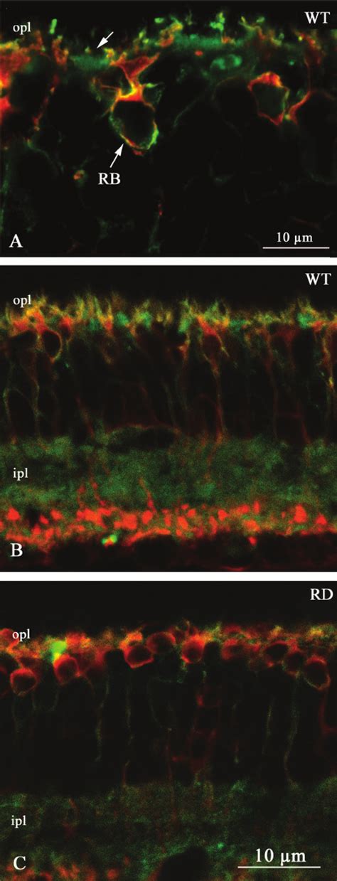 Dendritic Changes In Depolarizing Cone Bipolars And Rod Bipo Lars