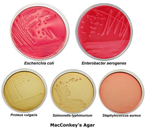 Proteus Vulgaris Colony Morphology On Nutrient Agar | nutrienkarbo