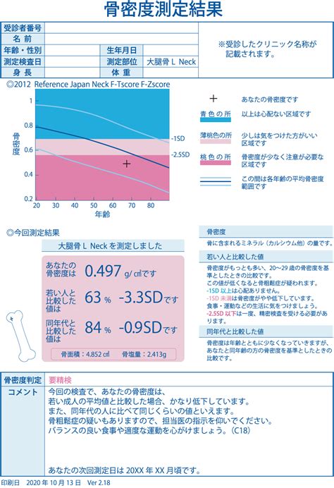 骨粗鬆症の診断 骨検 By 旭化成ファーマ