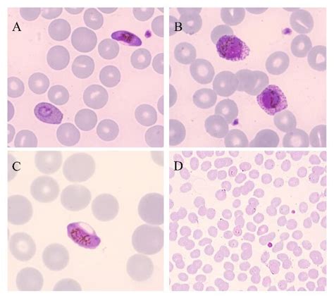 Plasmodium Ovale Gametocyte