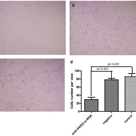 Apoptosis In Mcf 7 Cells That Were Treated With Anti Padi2 Sirna As