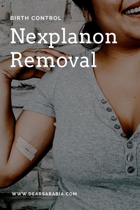 Nexplanon Birth Control Removal Nexplanon Birth Control Arm Implant Birth Control