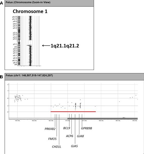 Array Comparative Genomic Hybridization ACGH On The DNA Extracted