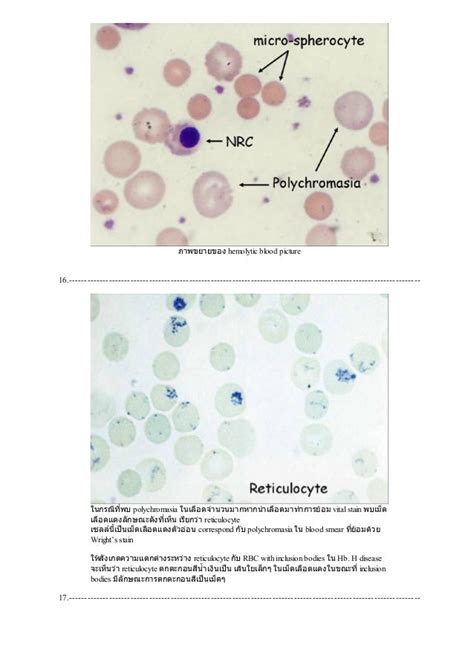 Peripheral Blood Smear Staining Procedure