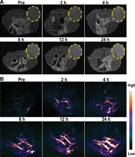 A T Weighted Mr And B Pa Imaging Of Mda Mb Luc Tumor Bearing