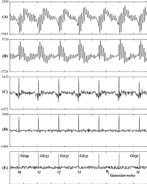 Examples Of The English Vowel I A Original Speech Signals B Download Scientific Diagram