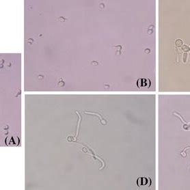 Candida Albicans Mycelia Growth Under Microscopic Observation