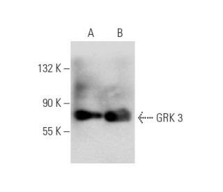 Anti GRK 3 Antibody C 11 SCBT Santa Cruz Biotechnology