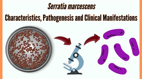 Serratia Marcescens Characteristics Pathogenesis Clinical