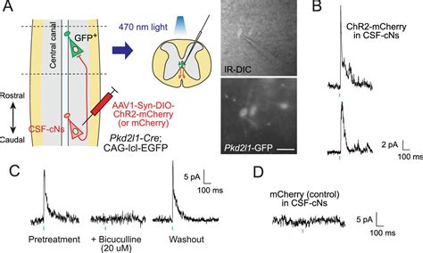 Figures And Data In Cerebrospinal Fluid Contacting Neuron Tracing