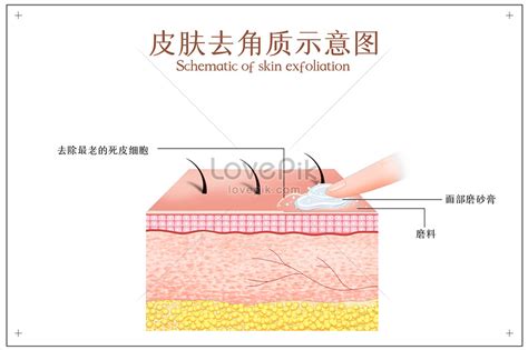 Schematic diagram of skin exfoliation illustration image_picture free ...