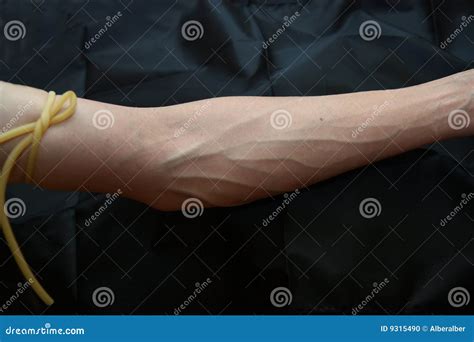 Blood Test Stock Photo Image Of Vein Test Band Vessel 9315490