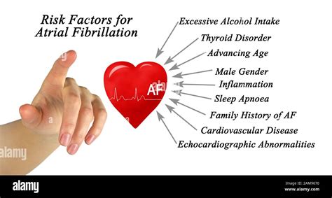 Risk Factors for Atrial Fibrillation Stock Photo - Alamy