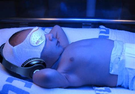 Neonatal Jaundice From Pediatric Emergency Playbook Podcast Episode On Podbay