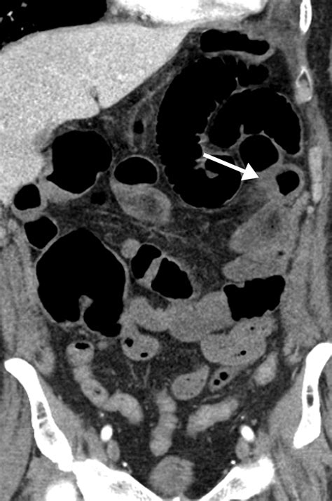 Multisystem Imaging Manifestations Of Covid Part Viral