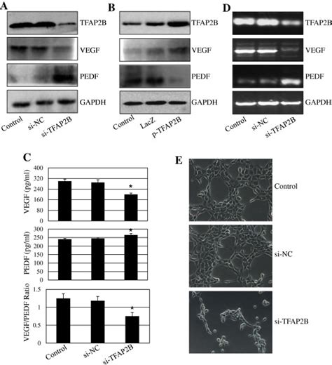 Tfap2b Knockdown Inhibits Vegfpedf Signaling And Angiogenesis Human