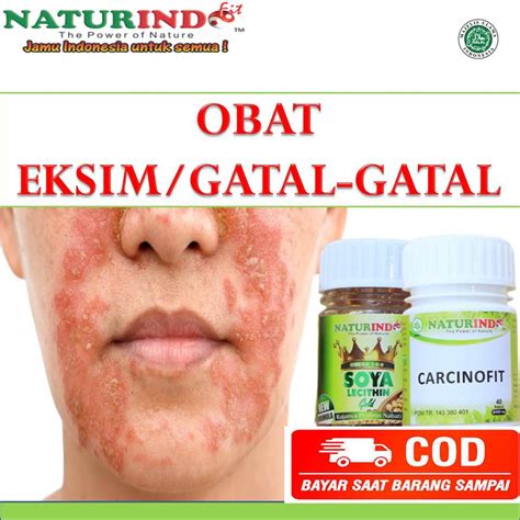 Jual Obat Eksim Gatal Gatal Sembuh Jamur Kulit Kudis Gudig Kurap Exim