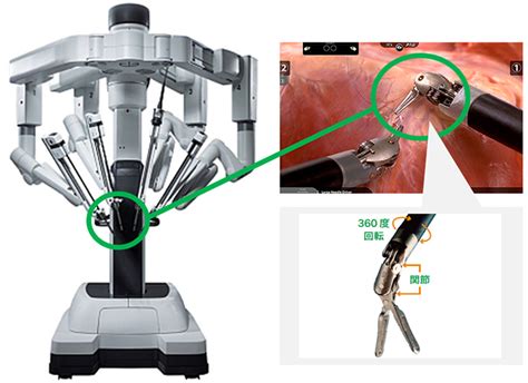 手術支援ロボット「ダビンチxi」を導入しました ライフスタイル ピカラダ 飯塚病院