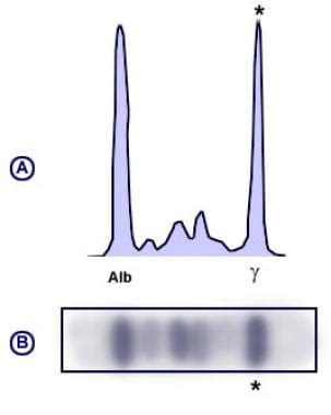 Protein Electrophoresis Eclinpath - Protein Info