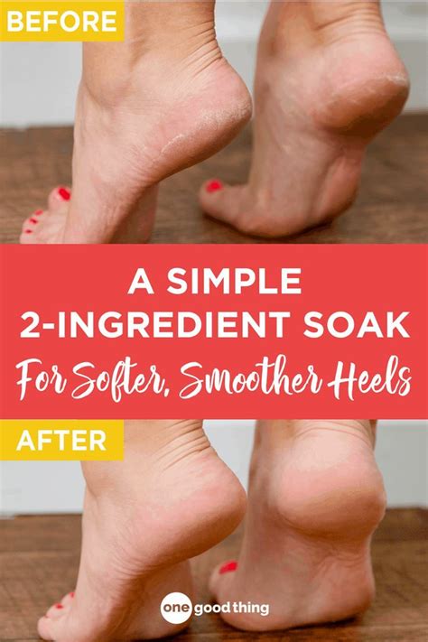 This Strange Sounding Foot Soak Of Listerine And Vinegar Works Wonders To Smooth And Soften Dry