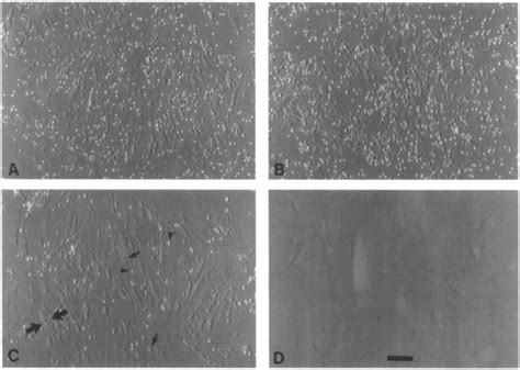 Differential Interference Contrast Light Microscopy Of T Cells Adherent