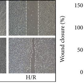 CMEC Derived Exosomes Prevent I R Injury And Pyroptosis In The Rat