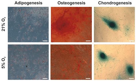 Multilineage Differentiation Potential Of Hwj Mscs Cultured Under 21 O