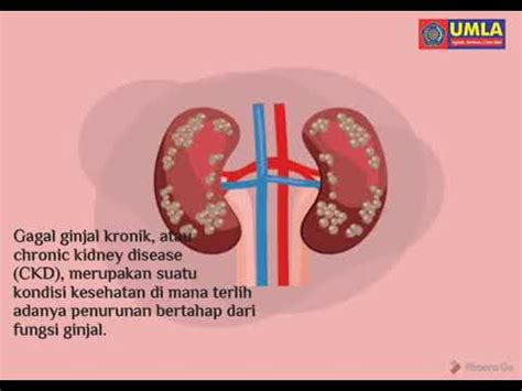 Video Edukasi Gagal Ginjal Kronik Ggk Youtube