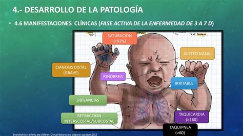 Caso Clinico Y Marco Teorico De La Bronquiolitis