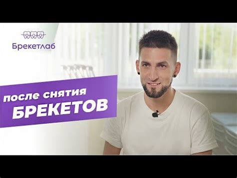После снятия брекетов (Брекетлаб) - YouTube