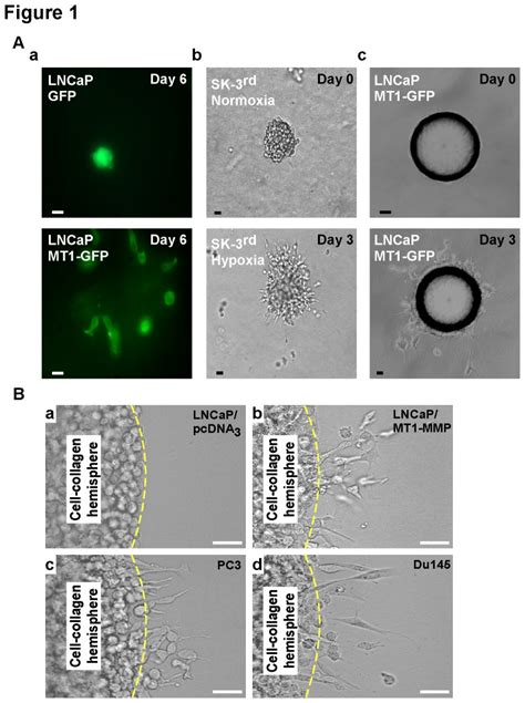 A A Single Cell Scattering Assay Single Isolated Lncap Cells Were