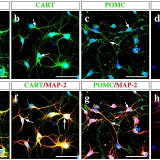 Orexigenic and anorexigenic neuropeptides are expressed in hypothalamic... | Download Scientific ...