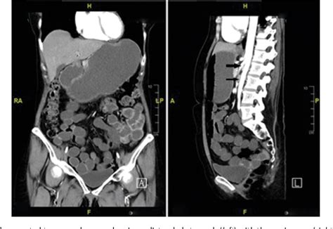 Figure 1 From The Clinical Value Of Serial Radionuclide Gastric