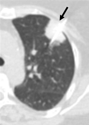 Amyloidosis Multisystem Spectrum Of Disease With Pathologic