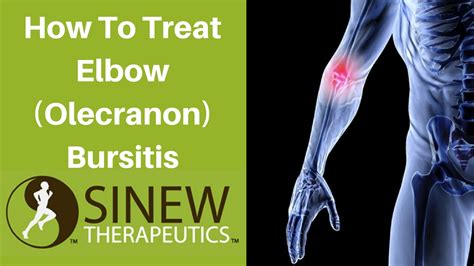 Olecranon Bursitis Carolina Regional Orthopedics