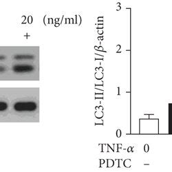 Tnf Induced Htr Svneo Cell Autophagy In A Dose Dependent Way Via