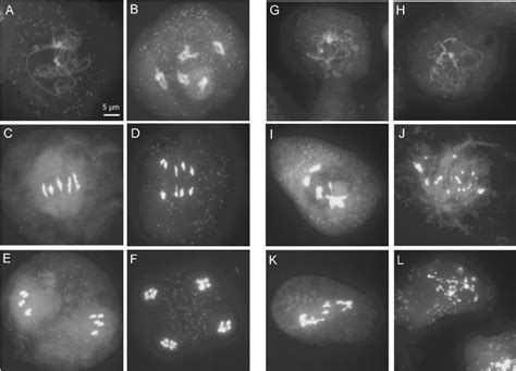 DAPI Staining Of Wild Type And CDC45 RNAi Pollen Mother Cells Shows