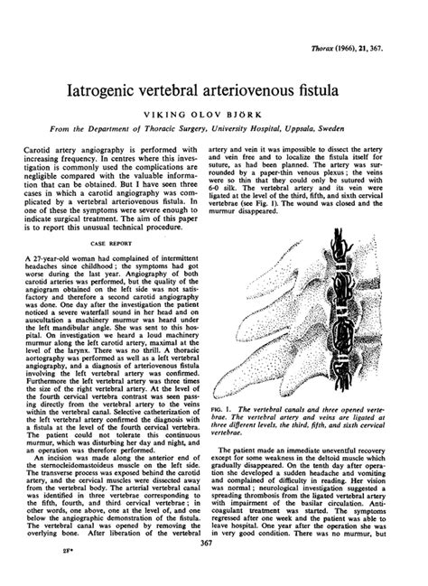 Iatrogenic Vertebral Arteriovenous Fistula Thorax