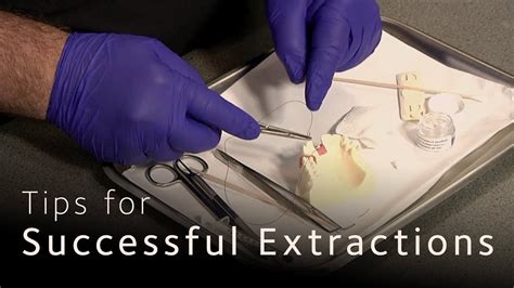 Minimally Invasive Dental Extractions YouTube