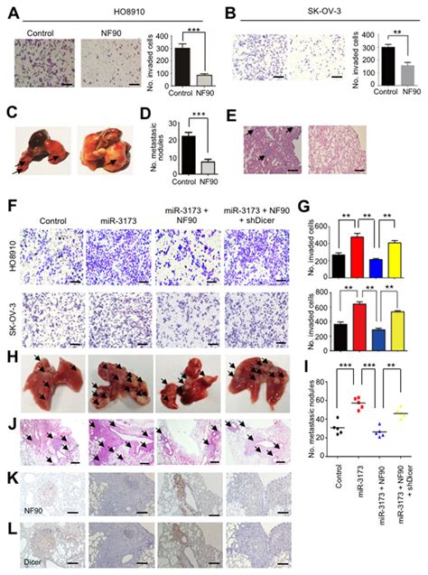 Nf Inhibits Ovarian Cancer Cell Motility And Metastasis In Vivo