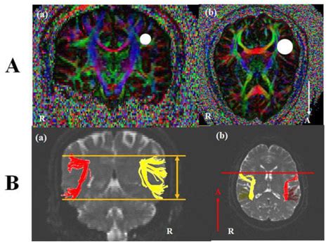 Brain Sciences Free Full Text Structural Characteristic Of The