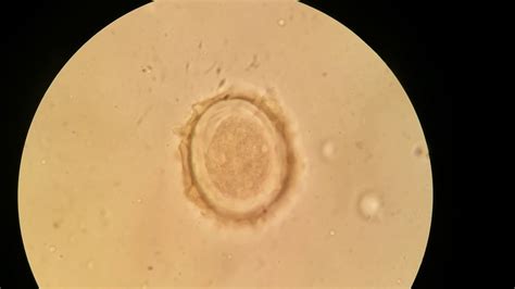 Ascaris Lumbricoides Microscope