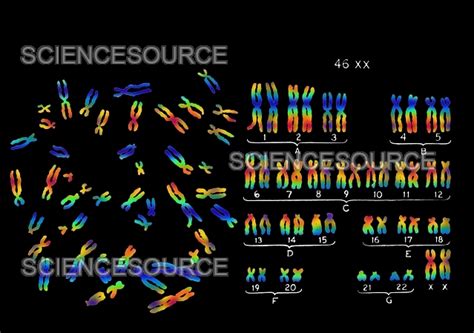 Normal Female Karyotype | Stock Image - Science Source Images