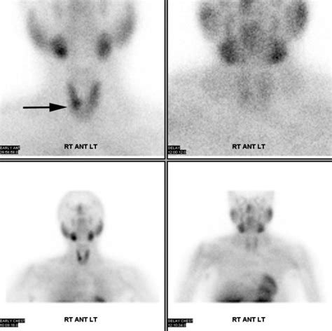 Clinical Images Four Dimensional Computed Tomography—future Of