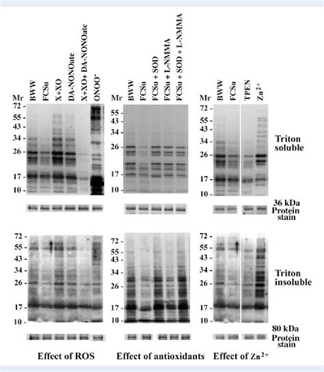 Figure 3 From Levels Of Semenogelin In Human Spermatozoa Decrease