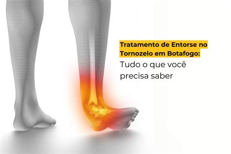 Tratamento de Entorse no Tornozelo em Botafogo Tudo o que Você Precisa